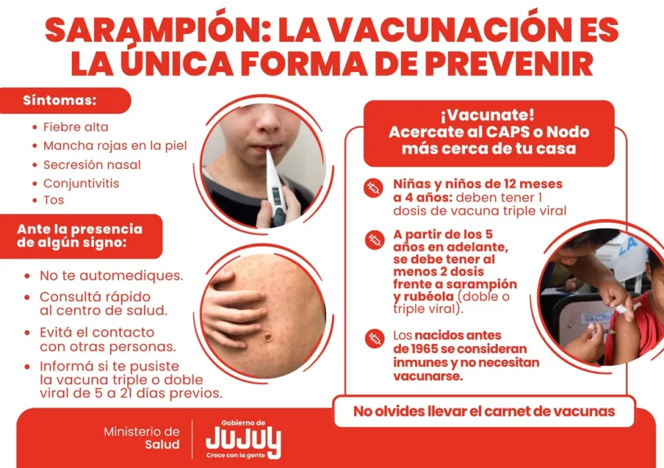 La vacunación es la única forma de prevenir el sarampión